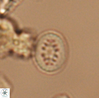 Heterorhabdus actinosus 13116