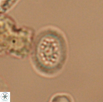 Heterorhabdus actinosus 13117