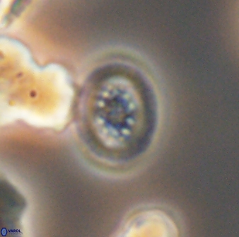 Heterorhabdus actinosus 13118