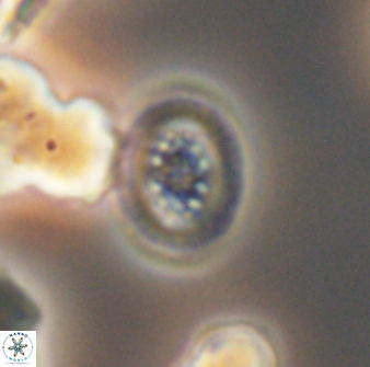Heterorhabdus actinosus 13118