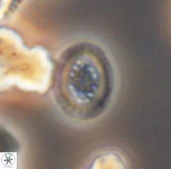 Heterorhabdus actinosus 13119
