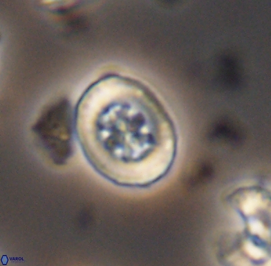 Heterorhabdus angustiforatus 11566