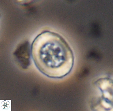 Heterorhabdus angustiforatus 11566