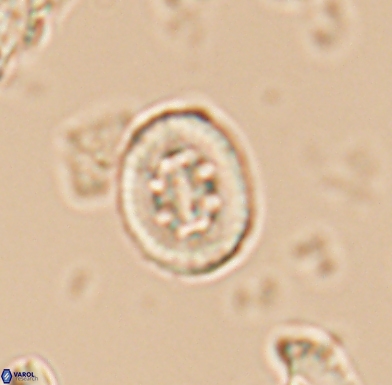 Heterorhabdus angustiforatus 11567