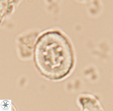 Heterorhabdus angustiforatus 11567
