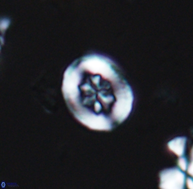 Heterorhabdus angustiforatus 11568