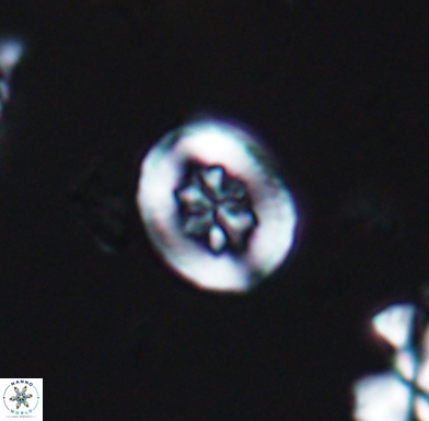 Heterorhabdus angustiforatus 11568