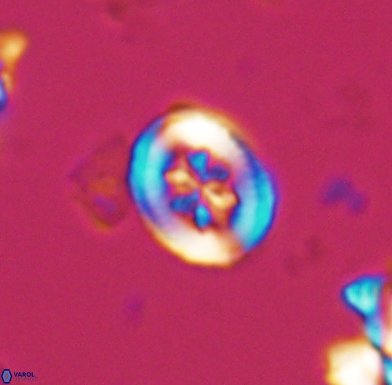 Heterorhabdus angustiforatus 11569