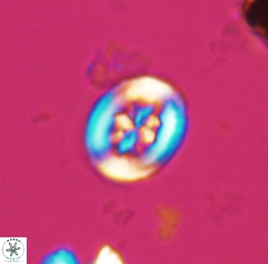 Heterorhabdus angustiforatus 11574