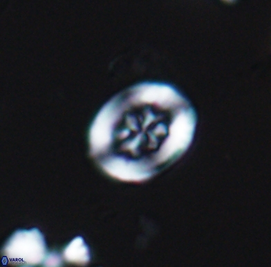 Heterorhabdus angustiforatus 11575