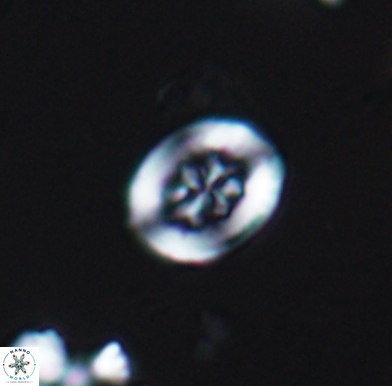Heterorhabdus angustiforatus 11575