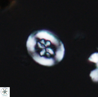 Heterorhabdus angustiforatus 11577