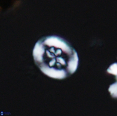 Heterorhabdus angustiforatus 11578