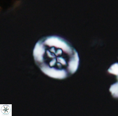 Heterorhabdus angustiforatus 11578