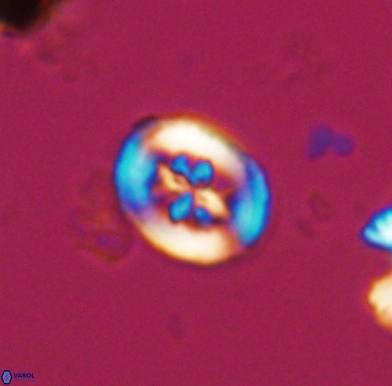 Heterorhabdus angustiforatus 11579