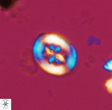 Heterorhabdus angustiforatus 11579