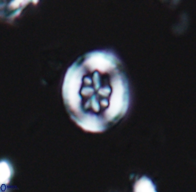 Heterorhabdus angustiforatus 11570