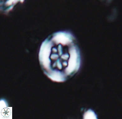 Heterorhabdus angustiforatus 11570