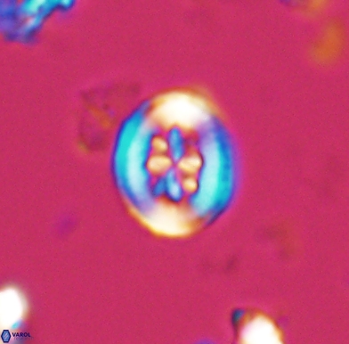 Heterorhabdus angustiforatus 11571