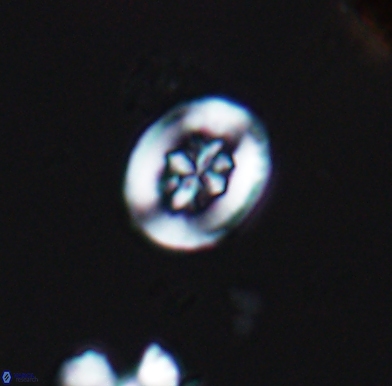 Heterorhabdus angustiforatus 11572