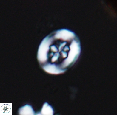 Heterorhabdus angustiforatus 11572