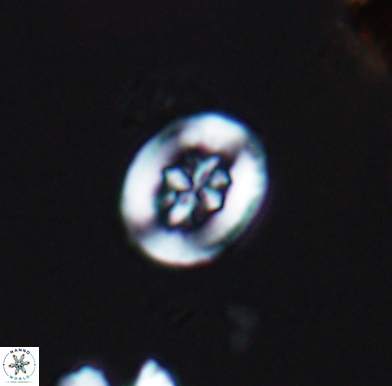 Heterorhabdus angustiforatus 11573