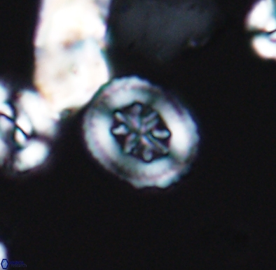 Heterorhabdus angustiforatus 11585