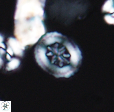 Heterorhabdus angustiforatus 11585