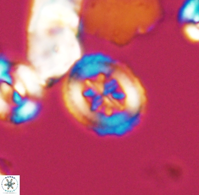 Heterorhabdus angustiforatus 11586