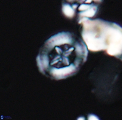 Heterorhabdus angustiforatus 11587