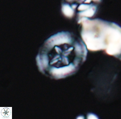 Heterorhabdus angustiforatus 11587