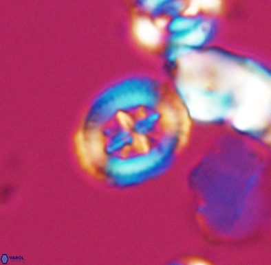 Heterorhabdus angustiforatus 11588