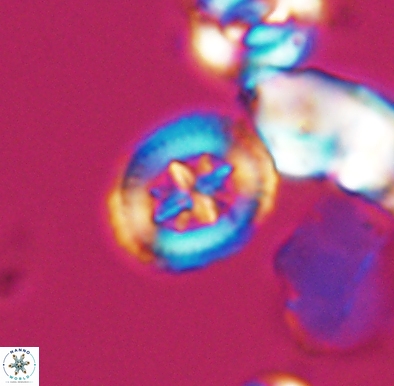 Heterorhabdus angustiforatus 11588