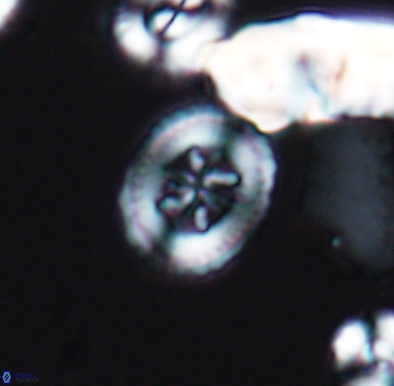 Heterorhabdus angustiforatus 11589