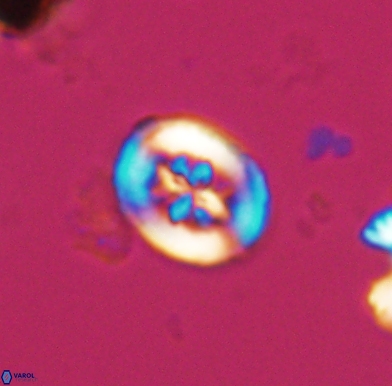 Heterorhabdus angustiforatus 11580