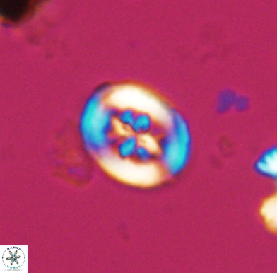 Heterorhabdus angustiforatus 11580
