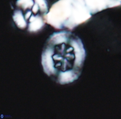 Heterorhabdus angustiforatus 11581