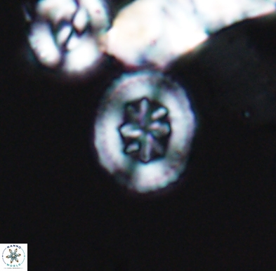 Heterorhabdus angustiforatus 11581