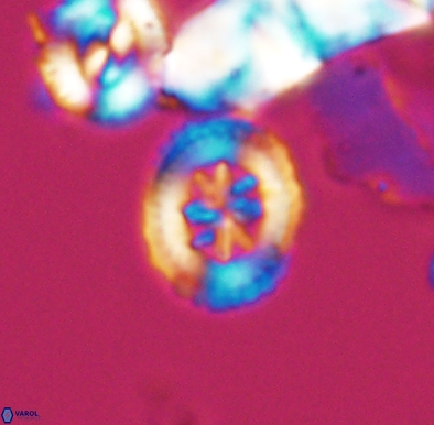 Heterorhabdus angustiforatus 11582