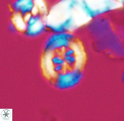 Heterorhabdus angustiforatus 11582