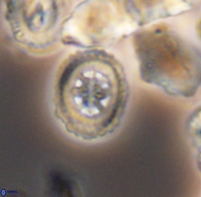 Heterorhabdus angustiforatus 11594