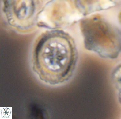 Heterorhabdus angustiforatus 11594
