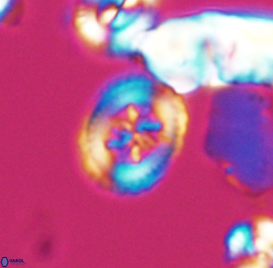 Heterorhabdus angustiforatus 11590