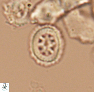 Heterorhabdus angustiforatus 11591
