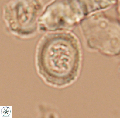 Heterorhabdus angustiforatus 11592