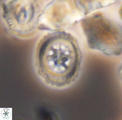 Heterorhabdus angustiforatus 11593
