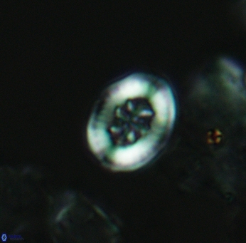 Heterorhabdus angustiforatus 3565