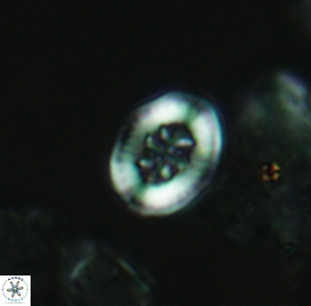 Heterorhabdus angustiforatus 3565