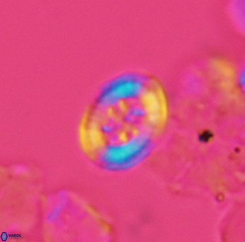 Heterorhabdus angustiforatus 3566