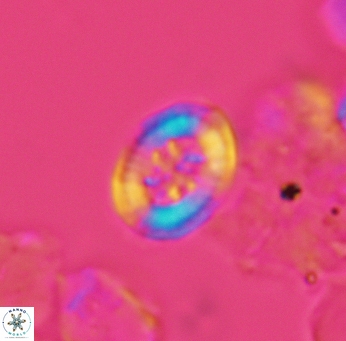 Heterorhabdus angustiforatus 3566